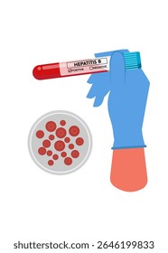 Hand holding blood sample for Hepatitis B test stock illustration