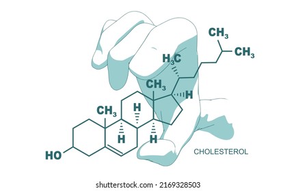 Hand Holding Chemical Molecular Formula Of Cholesterol.