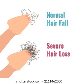 Hand holding hair clump. Normal hair fall versus severe hair loss. Alopecia diagnostics concept. Cartoon vector illustration