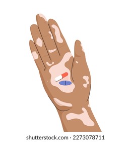 Hand holding pills, drugs, vitamins. Medicines. Healthcare and medicine concept. Simple flat minimalist style. Vitiligo arms.