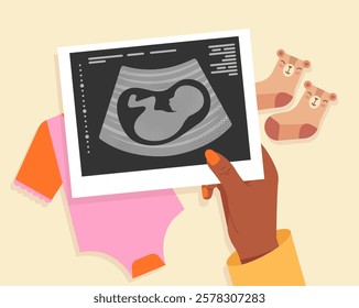 Hand holding ultrasound image with baby onesie and bear-patterned socks on a pastel background. Concept of pregnancy, motherhood, and anticipation. Vector illustration