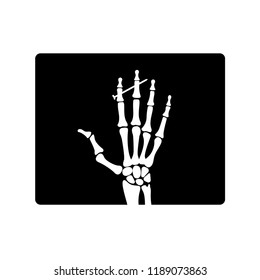 Hand Injury X ray Image Icon