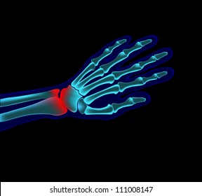 3,078 Wrist pain Stock Vectors, Images & Vector Art | Shutterstock