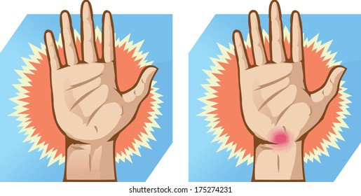 Hand pain