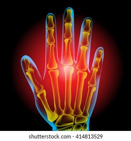 Hand pain
