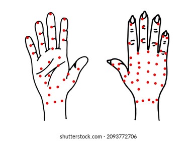 Hand palm and dorsal side sketch. Alternative medicine and treatment. Chinese red points acupuncture scheme drawing. Medical vector eps illustration