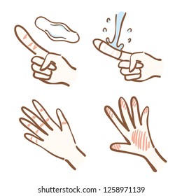 Hand roughness and treatment method