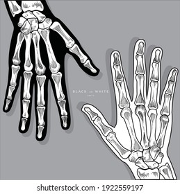 Hand skeleton Black or White