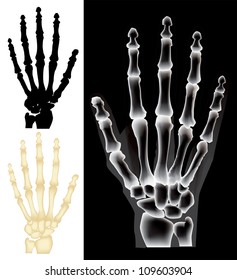 Hand skeleton xray set