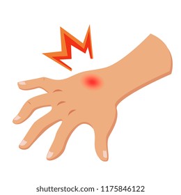 mano con la irritación de la piel. Picor, picor, enfermedades de la piel, enrojecimiento caricatura ilustración vectorial