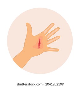 A hand with wound on palm that bleeding on pink circle background