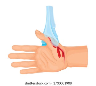 Hand With Wound Streaming Blood Under Cold Tap Water For Bleeding Control Vector Illustration