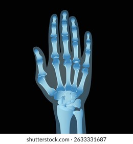 Hand X Ray, Human anatomy skeleton vector illustration