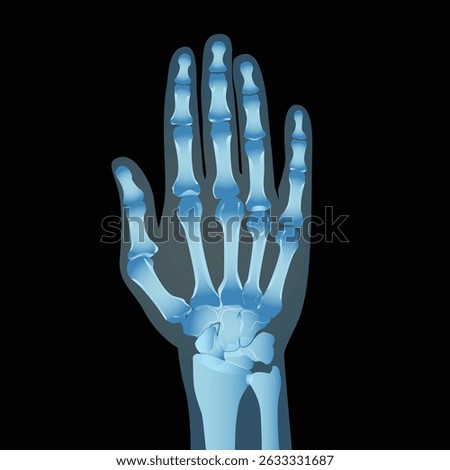 Hand X Ray, Human anatomy skeleton vector illustration