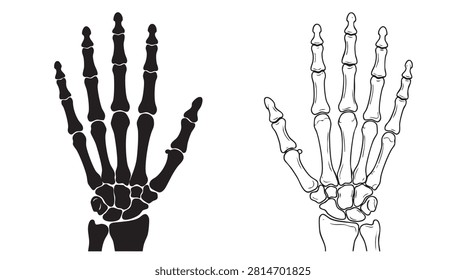 hand x  ray