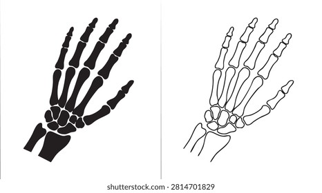 hand x  ray