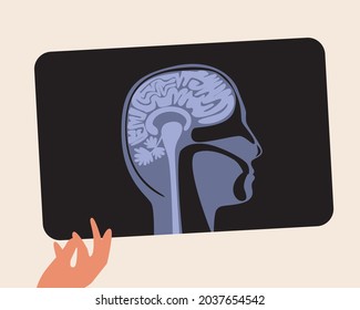 Hand and x-ray with the brain. Flat vector stock illustration. Brains and head examination concept. Inflammation or illness, concussion. X-ray examination snapshot. Isolated illustration