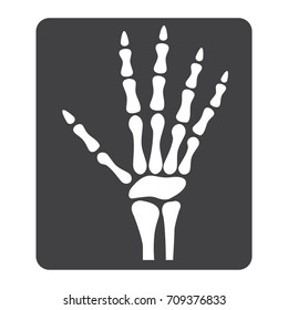 Hand X-ray glyph icon, medicine and healthcare, radiology sign vector graphics, a solid pattern on a white background, eps 10.