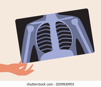 Hand and x-ray with lungs. Flat vector stock illustration. Concept of examination of the bronchi and lungs. Bronchitis or illness. Health care. X-ray examination snapshot. Isolated illustration