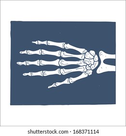 Hand X-ray picture. Sketch vector element for medical or health care design