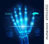 hand x-ray with technological theme, concept of health-care technology
