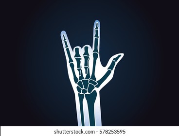 Hand X-ray while doing love sign. This illustration about love concept and health care.