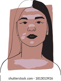 Hand-draw outline portrait of a young  woman with vitiligo  and dark beige sample color. Abstract colletion of different people and skin tones. Diversity concept