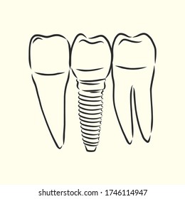 Hand-drawn black lines sketch molar, tooth. Doodle drawing. Object, Element, icon Component for illustration, design brochures for dentistry, medical manuals, books or packaging, isolated vector
