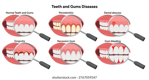Hand-drawn illustration set showing common dental and gum problems, including periodontitis, gingivitis, gum recession, dental abscess, and gum bleeding. Educational infographic 