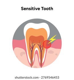Hand-drawn illustration of tooth sensitivity anatomy in educational style. Tooth structure, exposed dentin, enamel wear, and nerve pathways that cause sensitivity 