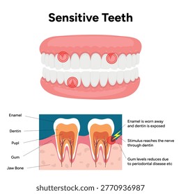 Hand-drawn illustration of tooth sensitivity with visual examples teeth. Educational enamel wear, exposed dentin, and reaction to hot and cold stimuli. causes of tooth sensitivity and oral discomfort