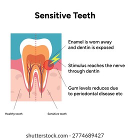 Hand-drawn illustration of tooth sensitivity with visual examples teeth. Educational enamel wear, exposed dentin, and reaction to hot and cold stimuli. causes of tooth sensitivity and oral discomfort