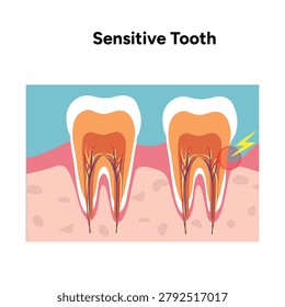 Hand-drawn illustration of tooth sensitivity with visual examples teeth. Educational enamel wear, exposed dentin, and reaction to hot and cold stimuli. causes of tooth sensitivity and oral discomfort