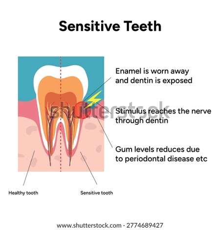 Hand-drawn illustration of tooth sensitivity with visual examples teeth. Educational enamel wear, exposed dentin, and reaction to hot and cold stimuli. causes of tooth sensitivity and oral discomfort