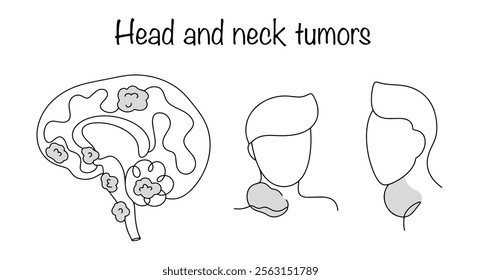 Hand-drawn main locations of brain and neck tumors. A group of tumors united by the same localization, mainly developing in squamous epithelial cells. A simple illustration for medical use.