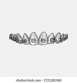 Hand-drawn sketch of teeth and braces on a white background. Dental instruments. Dentistry tools and equipment. Stomatology attributes