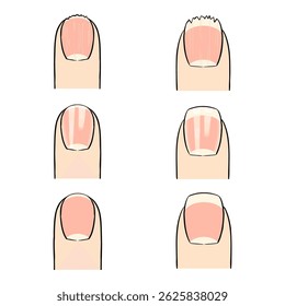 A hand-drawn vector of three types of Asian nails:damaged and unhealthy,glossy and beautiful,and normal.