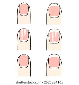 Um vetor desenhado à mão de três tipos de pregos caucasianos: danificados e insalubres, brilhantes e bonitos, e normais.