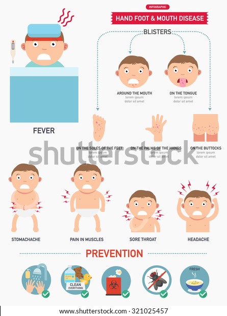 Handfoot Mouth Disease Infographicvector Illustration Stock Vector ...