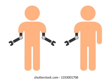 Handicapped, disabled and crippled armless man with prosthesis and prosthetic device. Prosthetics as replacement for missing body part.. Vector illustration