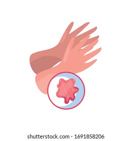 Hands and covid 19 virus flat style icon design of 2019 ncov cov coronavirus infection corona epidemic disease symptoms and medical theme Vector illustration