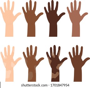 
Hands in different skin color options