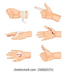 Hands mit verschiedenen Arten von Wunden Cartoon-Illustration Set. Verbundener Arm, schneiden und brennen auf menschliche Hand und Hand mit Gips. Wohn-, Gesundheits-, Krankenhaus-, Erste-Hilfe-Konzept