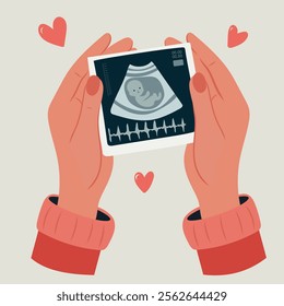 Hands holding a photo of a baby on an ultrasound in the womb. Ultrasound of a baby. Pregnancy. Cartoon vector illustration