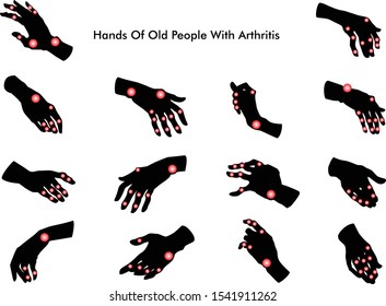 Hands of old people with arthritis. Silhouette. Vector illustration