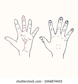 Hands (palm of left hand and dorsum of right hand) Korean acupuncture scheme with red points, hand drawn doodle, sketch in pop art style, black and white medical vector illustration
