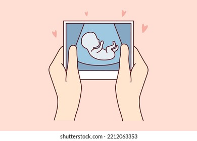 Hands of person holding scan of embryo waiting for baby birth. Future mother with ultrasound picture of baby. Motherhood concept. Vector illustration. 