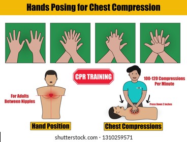 Hands Posing for Chest Compressions Step in CPR Emergency Rescue Process Training on Adult Human Manikin - Info Graphic Flat Design