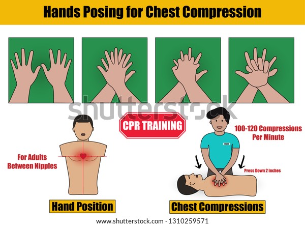 Hands Posing Chest Compressions Step Cpr Stock Vector (Royalty ...