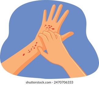 
Hands Scratching Having Eczema Problems Vector Illustration. Person feeling itchy suffering from topic skin condition
